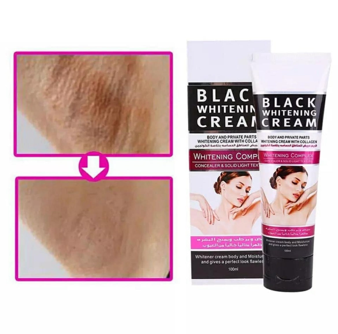 Crema blanqueadora