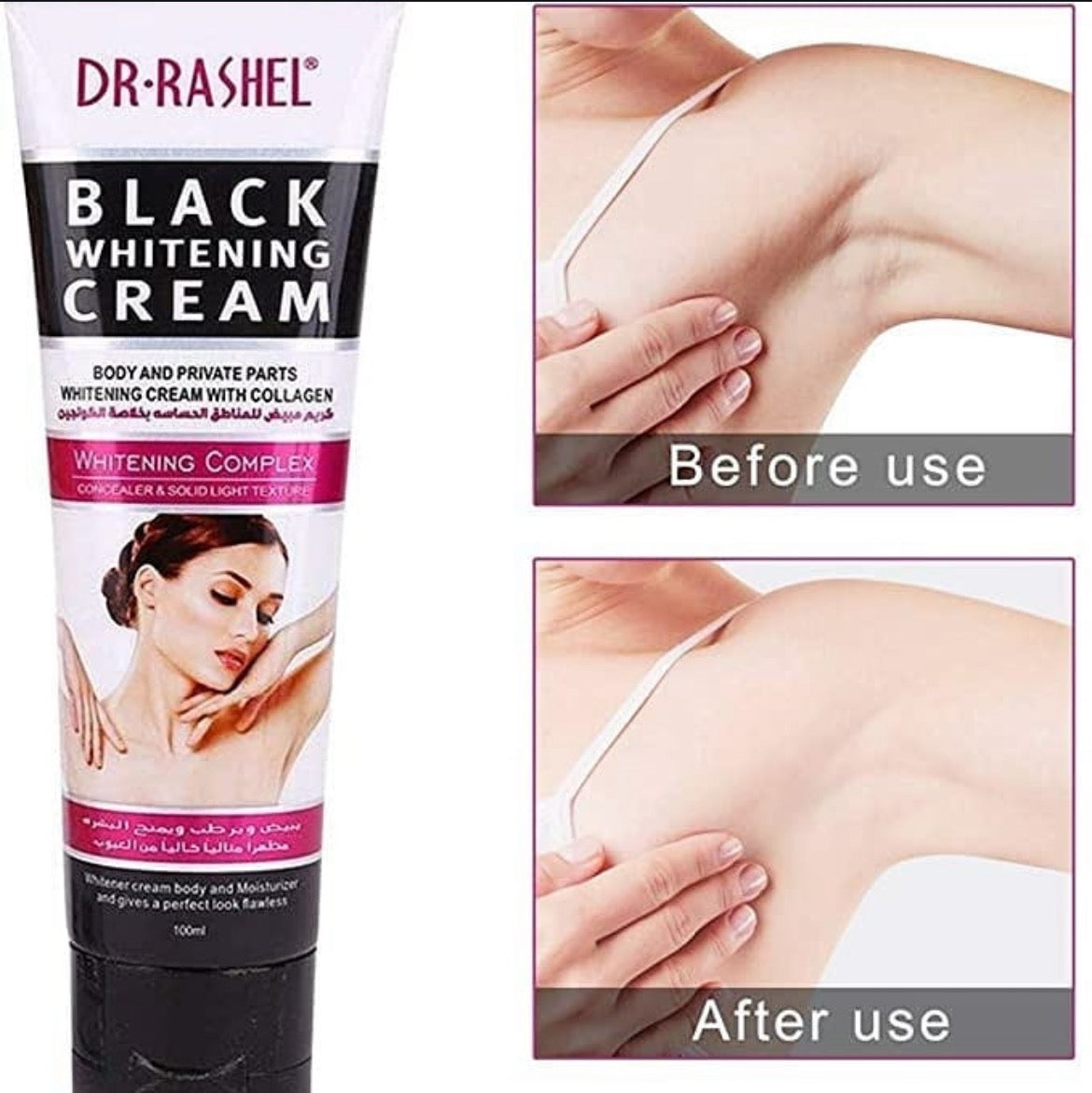 Crema blanqueadora