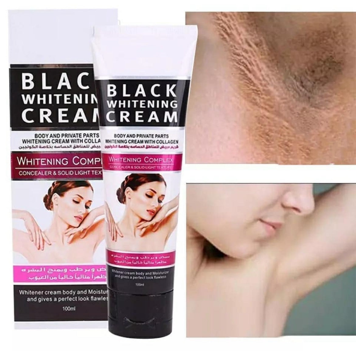 Crema blanqueadora